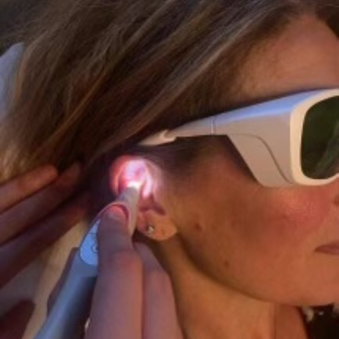 Centre Tabac Laser - Centre Tatérapi Laser de Chessy